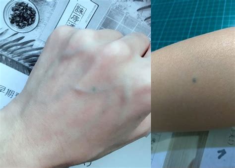 香港網名 疤痕刺青